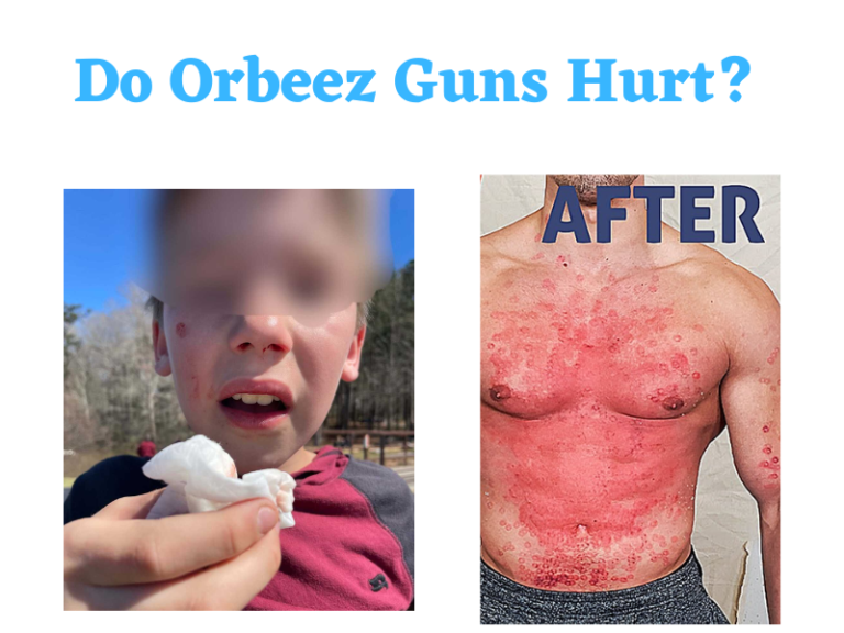 Do Orbeez Guns Hurt?